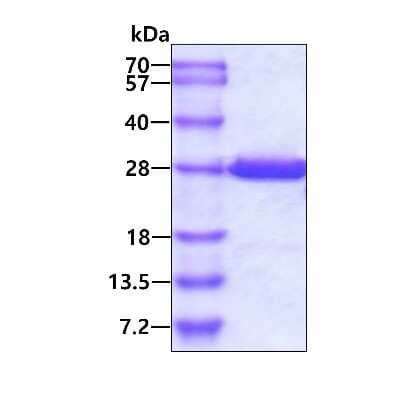 SDS-PAGE: Recombinant Human Crk His Protein [NBP1-50852]